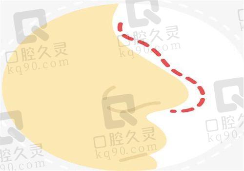 五、常熟金山医疗美容诊所价格表：（仅供参考）