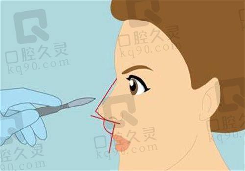 二、重庆当代整形医院擅长的不同项目技术优势、医生水平
