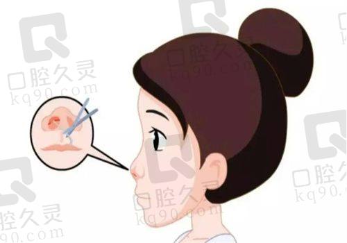 重庆当代整形医院好吗？医生经验丰富，尤其是脂肪隆胸技术优秀，真实手感备受好评