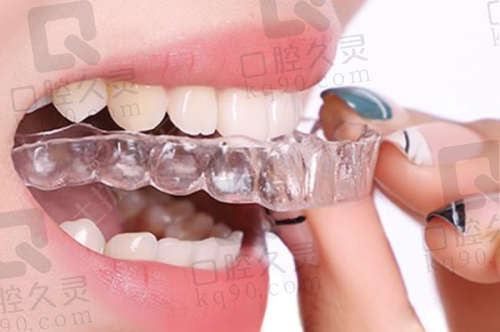 贺州拜尔口腔杨智亮医生种植修复怎么样?