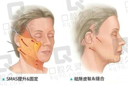 广州壹加壹医疗美容医院地址在哪里？位于广州市越秀区东风东路617号，地理位置优越，交通便利