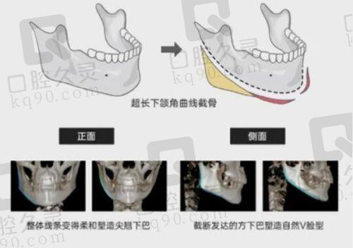 五、哈尔滨艺星与瑞丽整形医院的患者口碑分享