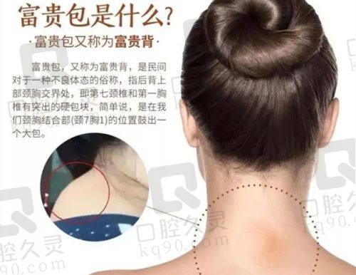 三、哈尔滨瑞丽和恩喜的口碑实例分享
