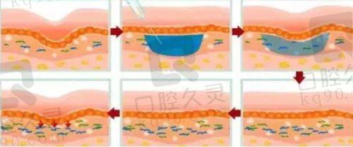重庆当代整形好不好？真实口碑揭示其隆鼻、双眼皮与丰胸技术的优势与效果分析
