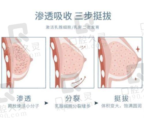无痕筋摸提升技术的特色在哪里？