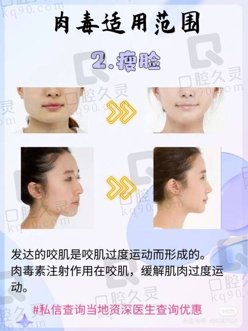 西安高一生医疗美容医院口碑好吗？真实顾客评价与手术效果揭秘！