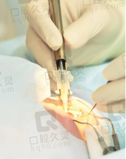 玉林华厦眼科医院怎么样？医生实力强术式全服务好，设备优价格低获患者好评