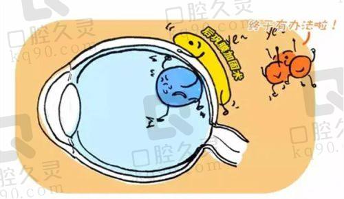 长春普瑞眼科医院做近视眼手术怎么样?技术、价格、案例优势尽显,定制方案超贴心