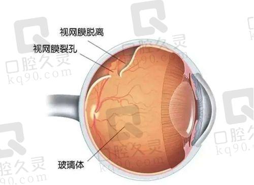 玉林华厦眼科医院患者评价如何