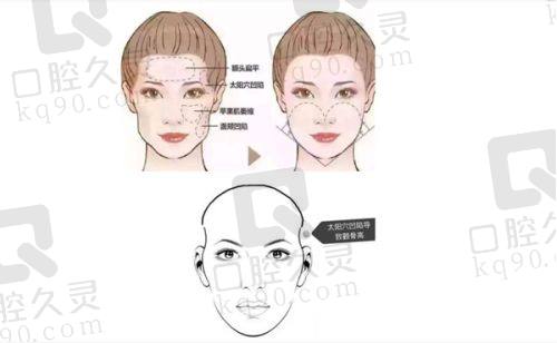 四、西安高一生美容整形医院在哪？