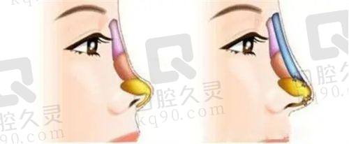 广州壹加壹医疗美容医院怎么样？医院正规性评测：真实案例与医师团队介绍，值得信赖的整形选择！