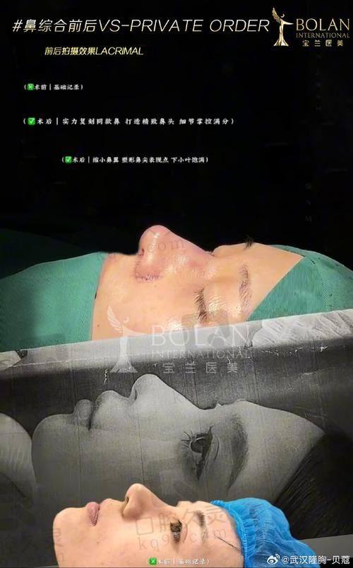淄博阳光整形美容医院——老牌医美机构的精细之美