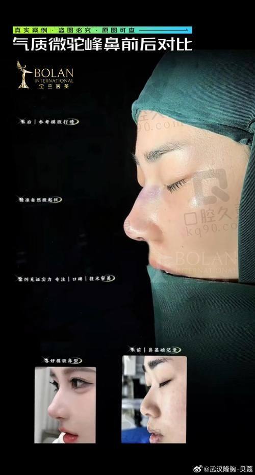 淄博美联臣整形美容医院——量身定制的精致整形