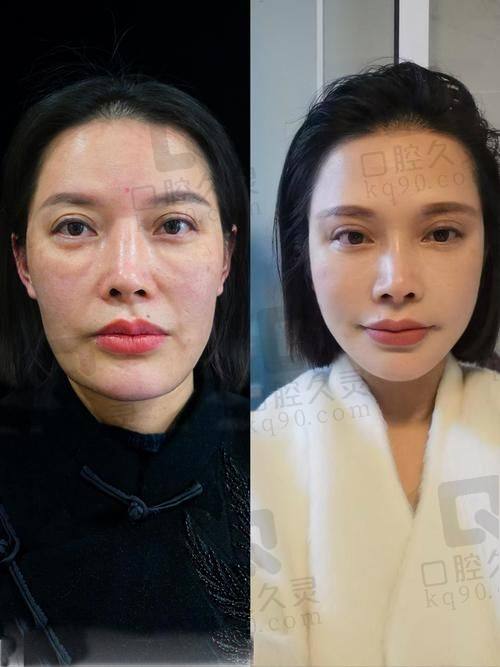 淄博向东美容整形医院——强大团队打造的整形先锋