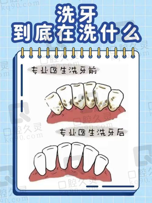 呼和浩特星耀口腔医院是正规的吗？当然了 当地老百姓评价高口碑好