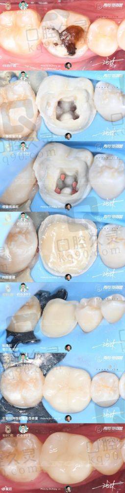 西宁中诺口腔医院可靠吗？正规资质、专业团队、合理收费给出肯定答案