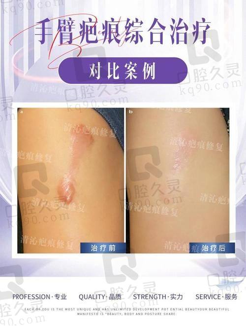 四川大学华 西医院李利医生优势