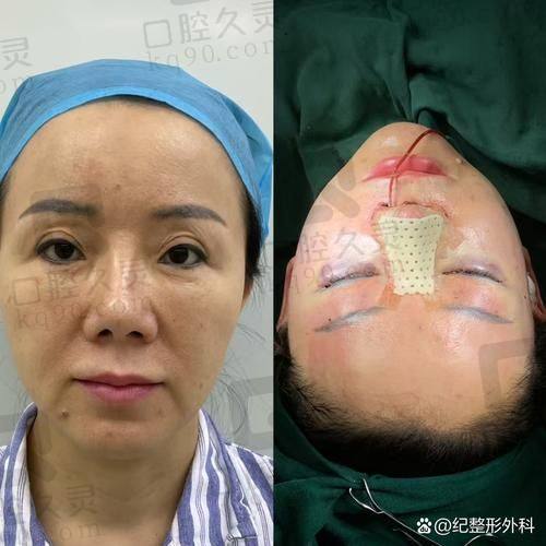 国内有哪些有名的拉皮手术医院？