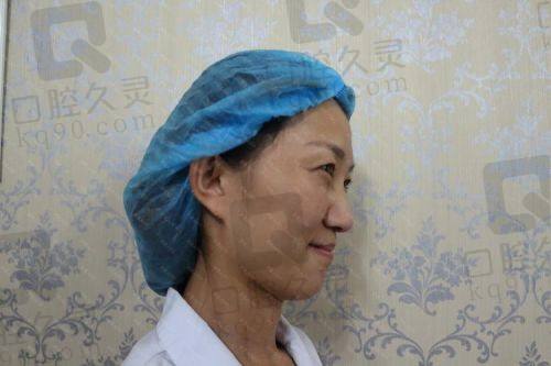台州艺星打童颜针的成效和感受如何？