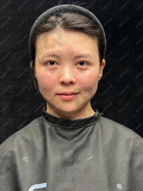 台州艺星打童颜针该选哪位医生？