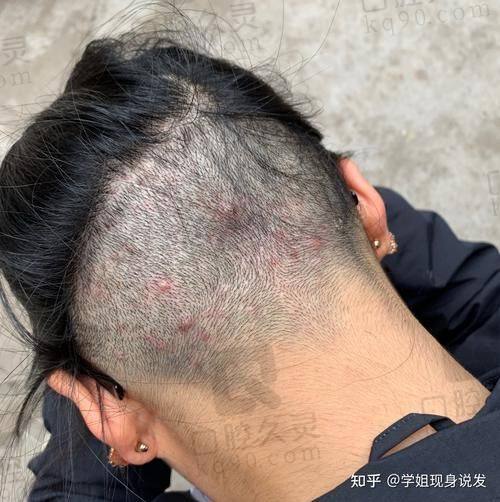 碧莲盛植发的口碑评价