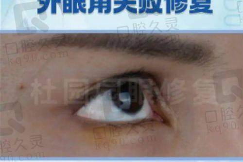 七、苏州铂蔓医疗美容门诊部真实的患者评价如下: