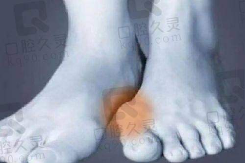贺州妙善美张永松医生面部五官精细化雕刻怎么样？