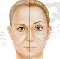 福州伽禾伽美医院医疗美容科口碑如何？