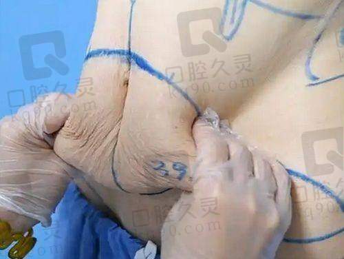 河南郑州整形医院排名前十，哪些医院技术领跑？