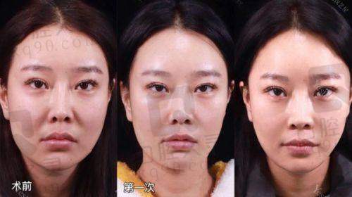 总结评价——福州美萨缔尔医疗美容门诊部怎么样？