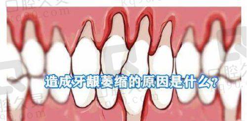 2025济宁中百口腔医院价目表公开，种植牙2980元起、补牙56元起！