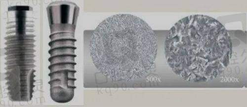 5. 杭州兒童口腔醫(yī)院牙貼面價格表