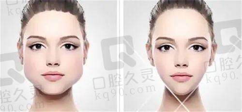 一、石家庄十八岁医疗美容诊所正规吗？