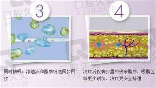 贺州妙善美医疗美容门诊部正规吗？