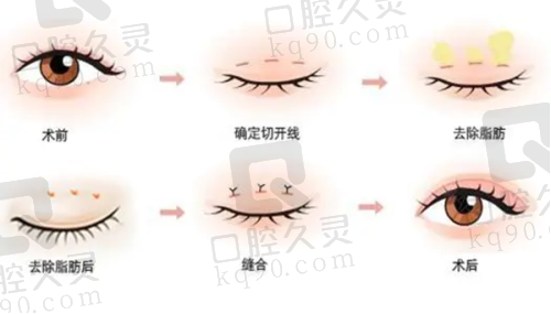 想找靠谱医美医院别愁!北京蕾士悦容私立正规,医生口碑超棒