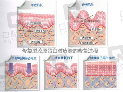 重庆当代整形王旭明医生鼻子整形技术特色