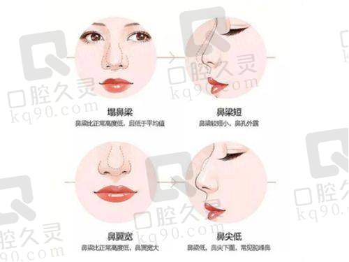 贺州妙善美张永松医生患者评价