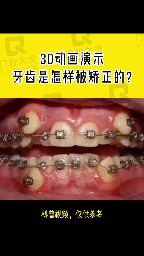 一、南宁牙齿矫正医院榜单前十名单