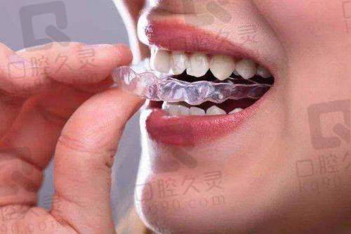 珠海海精灵口腔医院怎么样？靠谱吗？