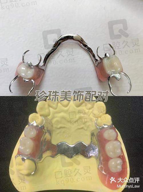 全口活动义齿的清洁和维护重要吗？