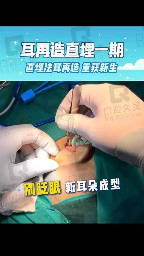 五、段伟强耳再造有名吗？患者口碑是关键