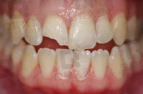 蚌埠德瓦口腔是正规医院吗？正规做种植牙好，多维度解析其正规优势与特色服务