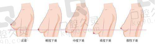 深圳鹏程医院疤痕科的整体实力