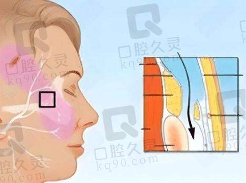 三、南京Adela医疗美容口碑实例分享