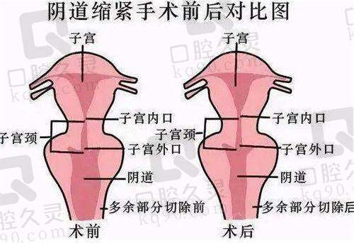 秦皇岛伊馥丽医疗美容诊所咋样？能割双眼皮，院长经验足，多项服务还享踏春优惠
