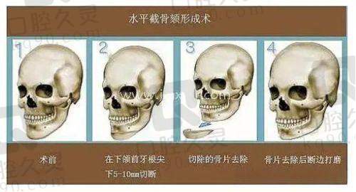 关于李俊霞医生幼态脸注射的常见问题有哪些？解答您的疑惑