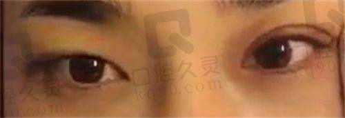 消费者对南京美莱的选择考量