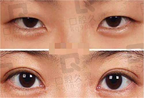秦皇岛琪媛医学美容诊所正规靠谱，眼部整形特色诊疗、口腔正畸价格亲民，值得一去