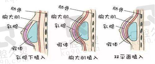 张医生的患者口碑：真实实例分享