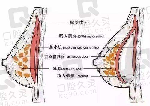 郑州东方整形医院是正规医院吗？医疗团队实力如何